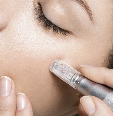 Mazoterapia s dermapenom